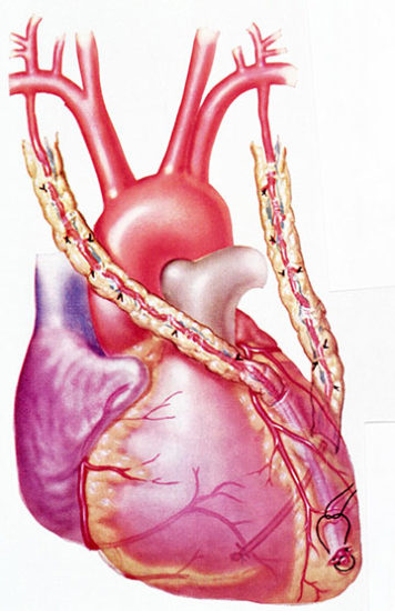 Coronary Artery Bypass Surgery